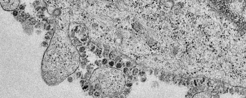 A microscope image of a cell infected with the novel coronavirus, grown in culture at the University of Hong Kong. Multiple virus particles are being released from the cell surface.Credit: John Nicholls, Leo Poon and Malik Peiris/The University of Hong Kong